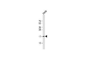 Anti-PTP4A2 Antibody (Center) at 1:1000 dilution + Hela whole cell lysate Lysates/proteins at 20 μg per lane. (PTP4A2 抗体  (AA 32-59))