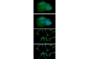 ICC/IF analysis of ARF1 in MCF7 cell line, stained with DAPI (Blue) for nucleus staining and monoclonal anti-human ARF1 antibody (1:100) with goat anti-mouse IgG-Alexa fluor 488 conjugate (Green). (ARF1 抗体)