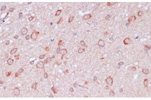 Immunohistochemistry of paraffin-embedded Rat brain using RPL32 Polyclonal Antibody at dilution of 1:100 (40x lens). (RPL32 抗体)