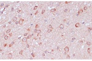 Immunohistochemistry of paraffin-embedded Rat brain using RPL32 Polyclonal Antibody at dilution of 1:100 (40x lens). (RPL32 抗体)