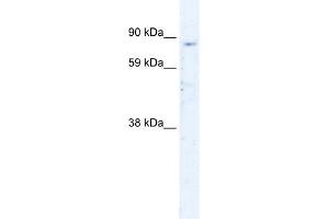 WB Suggested Anti-SIRT1 Antibody Titration:  0. (SIRT1 抗体  (N-Term))