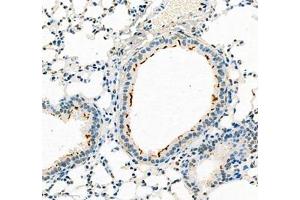 Immunohistochemistry (Paraffin-embedded Sections) (IHC (p)) image for anti-ATPase, H+ Transporting, Lysosomal 42kDa, V1 Subunit C2 (ATP6V1C2) antibody (ABIN7073157)