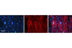 Rabbit Anti-PEA15 Antibody   Formalin Fixed Paraffin Embedded Tissue: Human heart Tissue Observed Staining: Cytoplasmic Primary Antibody Concentration: 1:100 Other Working Concentrations: N/A Secondary Antibody: Donkey anti-Rabbit-Cy3 Secondary Antibody Concentration: 1:200 Magnification: 20X Exposure Time: 0. (PEA15 抗体  (Middle Region))