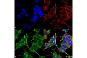 Immunocytochemistry/Immunofluorescence analysis using Mouse Anti-GluN2A/NR2A Monoclonal Antibody, Clone S327-95 . (NMDAR2A 抗体  (AA 75-325) (HRP))
