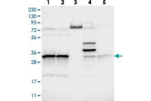 Western blot analysis of Lane 1: RT-4, Lane 2: U-251 MG, Lane 3: Human Plasma, Lane 4: Liver, Lane 5: Tonsil with MRPL45 polyclonal antibody  at 1:250-1:500 dilution. (MRPL45 抗体)