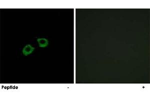 Immunofluorescence analysis of A-549 cells, using ARFGEF2 polyclonal antibody . (ARFGEF2 抗体)