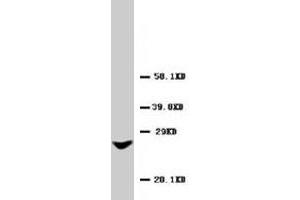 Western blot analysis of rat liver tissue lysate. (GJB2 抗体  (AA 1-16))
