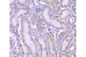 Immunohistochemistry of paraffin-embedded Rat kidney using ACAA1 Polyclonal Antibody at dilution of 1:100 (40x lens). (ACAA1 抗体)