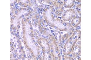 Immunohistochemistry of paraffin-embedded Rat kidney using ACAA1 Polyclonal Antibody at dilution of 1:100 (40x lens). (ACAA1 抗体)