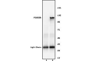 POLR2B antibody (pAb) tested by Immunoprecipitation. (POLR2B 抗体  (N-Term))