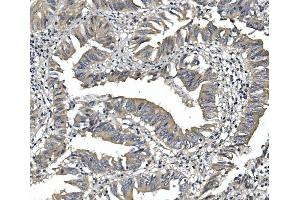 IHC analysis of PDE6 alpha/PDE6A using anti-PDE6 alpha/PDE6A antibody (ABIN7599710).