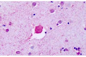 Anti-P2RY8 antibody IHC staining of human brain, cortex. (P2RY8 抗体  (Cytoplasmic Domain))