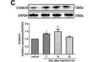 Minocycline reverted the A1/A2 ratio of reactive astrocytes and relieved mechanical allodynia in rats after SMIR. (GAPDH 抗体)