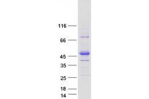 Western Blotting (WB) image for RasGEF Domain Family, Member 1C (RASGEF1C) protein (Myc-DYKDDDDK Tag) (ABIN2730536)