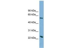 Image no. 1 for anti-Transmembrane Protein 161A (TMEM161A) (AA 179-228) antibody (ABIN6742031) (TMEM161A 抗体  (AA 179-228))