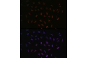 Immunofluorescence analysis of U-2 OS cells using SRSF3 antibody (ABIN6132649, ABIN6148465, ABIN6148466 and ABIN6221693) at dilution of 1:100. (SRSF3 抗体  (AA 1-90))