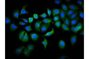 Immunofluorescence staining of A549 cells with ABIN7163552 at 1:133, counter-stained with DAPI. (PLS1 抗体  (AA 1-143))