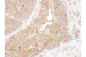 anti-Ribosomal Protein S5 (RPS5) (AA 1-50) antibody