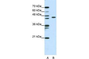 WB Suggested Anti-ZBTB9 Antibody Titration:  0. (ZBTB9 抗体  (N-Term))