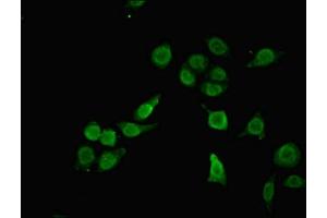 Immunofluorescent analysis of A549 cells using ABIN7168333 at dilution of 1:100 and Alexa Fluor 488-congugated AffiniPure Goat Anti-Rabbit IgG(H+L) (RBM12 抗体  (AA 1-200))