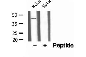Western blot analysis of extracts of HeLa cells, using TTL antibody. (TTL 抗体)