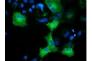 Immunofluorescence (IF) image for anti-Adenylate Kinase 5 (AK5) antibody (ABIN1496533) (Adenylate Kinase 5 抗体)