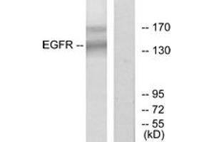 Western blot analysis of extracts from HT-29 cells, using EGFR (Ab-1172) Antibody. (EGFR 抗体  (AA 1139-1188))