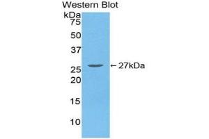 Western Blotting (WB) image for anti-Transforming Growth Factor, beta-Induced, 68kDa (TGFBI) (AA 423-632) antibody (ABIN7431149)