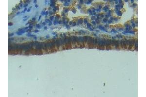 Immunohistochemistry (IHC) image for anti-Nitric Oxide Synthase 2, Inducible (NOS2) (AA 43-213) antibody (ABIN7432715)