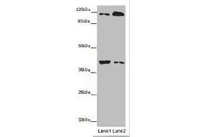 Western blot All lanes: MILR1 antibody at 14 μg/mL Lane 1: Mouse brain tissue Lane 2: HepG2 whole cell lysate Secondary Goat polyclonal to rabbit IgG at 1/10000 dilution Predicted band size: 39, 28, 29 kDa Observed band size: 39, 120 kDa (Allergin-1 抗体  (AA 249-343))