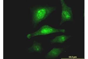 Immunofluorescence (IF) image for anti-Proprotein Convertase Subtilisin/kexin Type 1 Inhibitor (PCSK1N) (AA 173-260) antibody (ABIN525980)