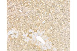 Immunohistochemistry (IHC) image for anti-Arginase, Liver (ARG1) (AA 1-322) antibody (ABIN7453894) (Recombinant Liver Arginase 抗体  (AA 1-322))