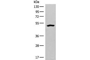 Western blot analysis of Human fetal liver tissue lysate using FBXO9 Polyclonal Antibody at dilution of 1:200 (FBXO9 抗体)