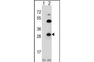 Western blot analysis of CLDN2 (arrow) using rabbit polyclonal CLDN2 Antibody  (ABIN656564 and ABIN2845824). (Claudin 2 抗体  (C-Term))