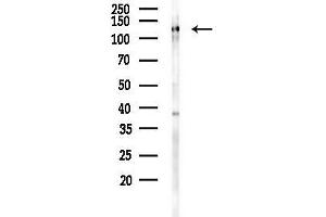 anti-Mitogen-Activated Protein Kinase 8 Interacting Protein 1 (MAPK8IP1) (pThr103) antibody