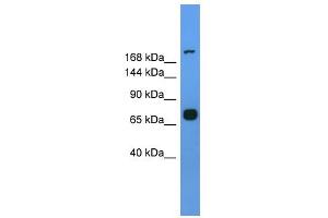 WB Suggested Anti-Myh7 Antibody Titration: 0. (MYH7 抗体  (Middle Region))