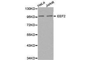 Western Blotting (WB) image for anti-Eukaryotic Translation Elongation Factor 2 (EEF2) antibody (ABIN1872437) (EEF2 抗体)