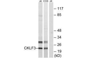 Western blot analysis of extracts from Jurkat cells and COS cells, using CKLF3 antibody. (CMTM3 抗体  (N-Term))