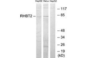 Western blot analysis of extracts from HepG2/HeLa cells, using RHBT2 Antibody. (RHOBTB2 抗体  (AA 61-110))
