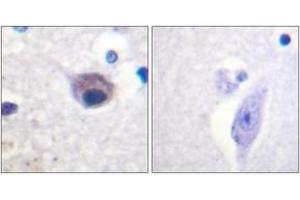 Immunohistochemistry (IHC) image for anti-Vav 2 Guanine Nucleotide Exchange Factor (VAV2) (AA 108-157), (pTyr142) antibody (ABIN1531758)