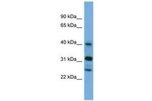 Image no. 1 for anti-Periphilin 1 (PPHLN1) (N-Term) antibody (ABIN6745665) (PPHLN1 抗体  (N-Term))