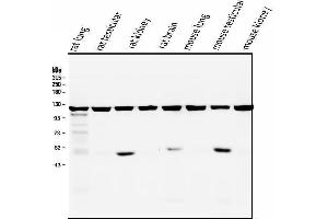 Western blot analysis of ATP citrate lyase using anti-ATP citrate lyase antibody (ABIN6719406). (ACLY 抗体  (AA 1-180))