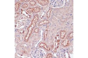 Immunohistochemistry (IHC) image for anti-Lysozyme (LYZ) (AA 1-100) antibody (ABIN6143409)
