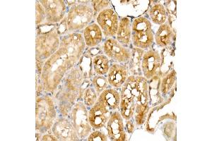 Immunohistochemistry of paraffin-embedded rat kidney using PGC1α Rabbit mAb  at dilution of 1:1000 (40x lens). (PPARGC1A 抗体)