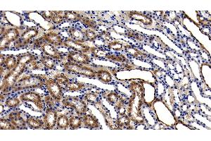 Detection of GPX1 in Rat Kidney Tissue using Polyclonal Antibody to Glutathione Peroxidase 1 (GPX1) (Glutathione Peroxidase 1 抗体  (AA 48-201))