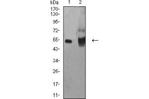 Western blot analysis using ALDH1A1 mouse mAb against HepG2 (1) and A549 (2) cell lysate. (ALDH1A1 抗体  (AA 1-110))