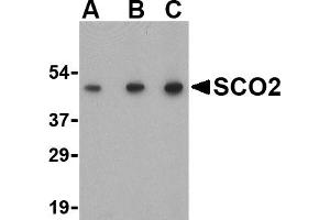 Western blot analysis of SCO2 in human liver tissue lysate with SCO2 antibody at (A) 0. (SCO2 抗体  (C-Term))