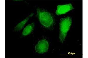 Immunofluorescence of purified MaxPab antibody to C20orf132 on HeLa cell. (C20orf132 抗体  (AA 1-608))