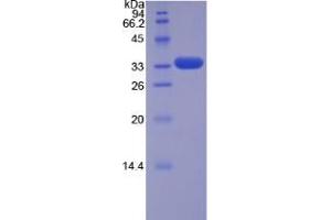 SDS-PAGE analysis of Human TRAF5 Protein. (TRAF5 蛋白)