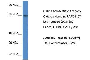Western Blotting (WB) image for anti-Acyl-CoA Synthetase Short-Chain Family Member 2 (ACSS2) (N-Term) antibody (ABIN2788690) (ACSS2 抗体  (N-Term))